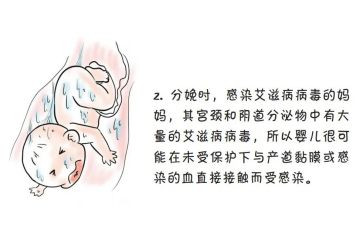 防艾滋病活动总结最新5篇