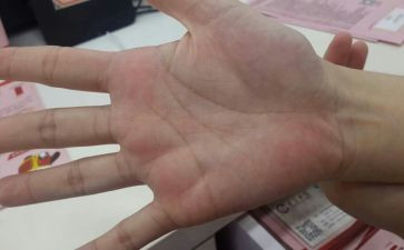 幼儿园手掌画教案5篇