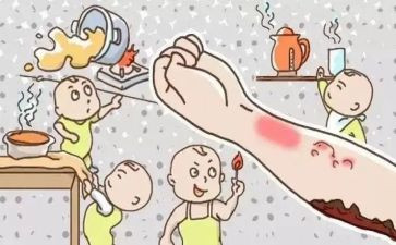 防烫伤教案6篇